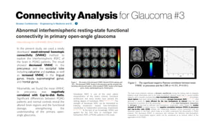 ConnectivityAnalysis for Glaucoma #3
https://doi.org/10.1109/EMBC.2016.7591617
In the present study, we used a newly
developed voxel-mirrored homotopic
connectivity (VMHC) method to
explore the interhemispheric RSFC of
the brain in POAG patients. The result
showed decreased VMHC in the
precuneus and the occipital lobe
including calcarine and cuneus, as well
as increased VMHC in the lingual
gyrus, insula, supramarginal gyrus,
and frontal gyrus.
Meanwhile, we found the mean VMHC
in precuneus was negatively
correlated with Cup-to-disk Ratio.
Significant differences between POAG
patients and normal controls reveal the
altered brain regions and the functional
damage, strengthening the
understanding of the primary open-
angle glaucoma.
Homotopic RSFC is one of the most salient
characteristics of the brain’s intrinsic functional
architecture and many studies have pointed the
striking degree of homotopic RSFC(Biswal et al., 1995)
. The
strength of homotopic RSFC can be interpreted as
indexing tendencies toward inter-hemispheric
coordinated or independent processing, respectively
(Zuo et al. 2010)
. To the best of our knowledge, VMHC was
applied for the first time to investigate inter-
hemispheric RSFC of POAG patients in this study.
The brain visual networks maintain a dynamic equilibrium during the resting state to integrate
bilateral visual information and to be ready to perform relevant visual task in normal healthy
subjects, and it requires corresponding inter-hemispheric interaction(Bressler and Kelso, 2001)
. Accordingly,
visual regions have been demonstrated to exhibited stronger homotopic RSFC(Stark et al., 2008)
. And
generally, it would be more efficient for the two hemispheres to interact than for one
hemispheric to perform all of the processing(Banich and Karol, 1992)
. If the inter-hemispheric interaction
is damaged, it may lead to deficient inter-hemispheric cooperation, which means the weaker
strength of VMHC in related regions. The negative correlation between VMHC in precuneus
and cup-to-disc ratio (CDR) exhibits the relationship between clinical parameters and the
abnormal regions in the brain, which helps us to better understand the abnormality in POAG
patients. The decreased VMHC in precuneus also indicates the deficient inter-hemispheric
cooperation in visual-related regions, which can be considered as an intrinsic reflect of the
aggravation of the POAG.
 
