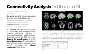 ConnectivityAnalysis for Glaucoma #4
http://dx.doi.org/10.1002/hbm.23330
In conclusion, the complex pathogenesis
of primary open angle glaucoma (POAG)
includes widespread damage of
anatomical connectivity (AC) and altered
functional connectivity (FC) within and
beyond the visual system since the
early disease stage. The association of
brain MRI changes with measures of visual
severity emphasizes the clinical
relevance of our findings.
 