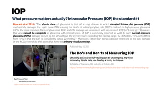 IOP
Whatpressuremattersactually?IntraocularPressure(IOP)thestandard#1
Boucard et al. 2016: “The classic view of glaucomab
is that of an eye disease in which elevated intraocular pressure (IOP)
mechanically damages the optic nerve (ON) causing the death of retinal ganglion cells (RGCs). Indeed, in high-pressure glaucoma
(HPG, the most common form of glaucoma), RGC and ON damage are associated with an elevated IOP (>21 mmHg).[1]
However,
this view cannot be complete as glaucoma with normal levels of IOP is commonly reported as well. In such normal-pressure
glaucoma (NPG), damage occurs to the ON without the eye pressure exceeding the normal range. By definition, NPG only differs
from HPG in that the IOP is consistently below 22 mmHG.[1]
Moreover, rather than being a disease restricted to the eye, damage
of the RCGs extends to the axons that form the primary visual pathways.c
https://www.youtube.com/watch?v=sgKeXb3PvBs
https://www.reviewofoptometry.com/article/the-dos-and-donts-of-measuring-iop
 