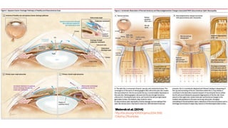 Weinrebetal.(2014)
http://dx.doi.org/10.1001/jama.2014.3192
Citedby219articles
 