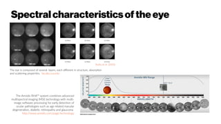 Spectralcharacteristicsoftheeye
The eye is composed of several layers, each different in structure, absorption
and scattering properties. faculty.cua.edu
Styles et al. (2005)
The Annidis RHA™ system combines advanced
multispectral imaging (MSI) technology with multi-
image software processing for early detection of
ocular pathologies such as age related macular
degeneration, diabetic retinopathy and glaucoma
http://www.annidis.com/page/technology
 