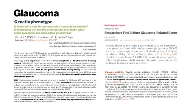 Dissertation on glaucoma