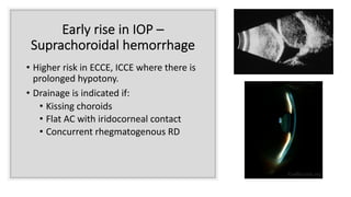Early rise in IOP –
Suprachoroidal hemorrhage
• Higher risk in ECCE, ICCE where there is
prolonged hypotony.
• Drainage is indicated if:
• Kissing choroids
• Flat AC with iridocorneal contact
• Concurrent rhegmatogenous RD
 