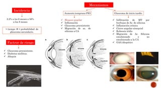 2.2% a los 6 meses a 56%
a los 8 meses
> tiempo  > probabilidad de
glaucoma secundario.
Incidencia
 Glaucoma preexistente.
 Diabetes mellitus.
 Afaquia
Factror de riesgo
Mecanismos
Aumento temprano PIO Glaucoma de inicio tardío
 Bloqueo pupilar
 Inflamación
 Glaucoma preexistente
 Migración de ac. de
silicona a CA
 Infiltración de MT por
burbujas de Ac. de silicona
 Inflamación crónica
 Cierre angular sinequial
 Rubeosis iridis
 Migración de Ac. Silicona
emulsionado y no
emulsionado a la CA
 GAA idiopático
 