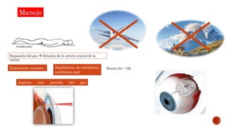 Manejo
Supresores acuosos
Aspirar una porción del gas
intraocular
Ihnibidores de anhidrasa
carbónica oral
Expansión del gas  Oclusión de la arteria central de la
retina
Dentro 24 – 72h
 