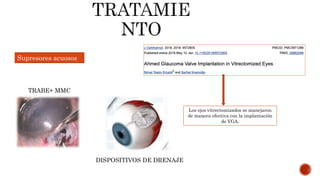 Supresores acuosos
TRABE+ MMC
DISPOSITIVOS DE DRENAJE
Los ojos vitrectomizados se manejaron
de manera efectiva con la implantación
de VGA.
 