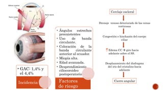 •GAC: 1,4% y
el 4,4%
Incidencia
• Ángulos estrechos
preexistentes
• Uso de banda
circulante.
• Colocación de la
banda circulante
anterior al ecuador.
• Miopía alta.
• Edad avanzada.
• Desprendimiento
ciliocoroideo
postoperatorio
Factores
de riesgo
Cerclaje escleral
Drenaje venoso deteriorado de las venas
vorticosas
Congestión e hinchazón del cuerpo
ciliar
Edema CC  giro hacia
adelante sobre el SS.
Desplazamiento del diafragma
del iris del cristalino hacia
adelante
Cierre angular
 