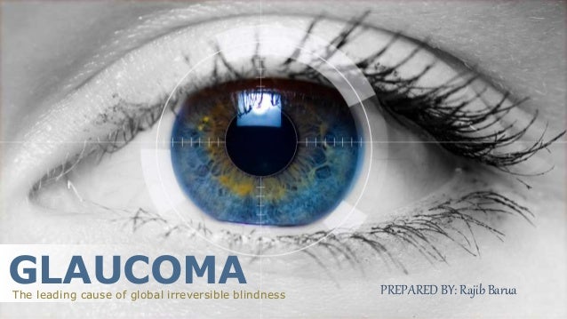 Glaucoma ppt Glaucoma ppt