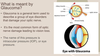 What is meant by
Glaucoma?
• Glaucoma is a general term used to
describe a group of eye disorders
that damage your optic nerve.
• It’s the most common form of optic
nerve damage leading to vision loss.
• The name of this pressure is
intraocular pressure (IOP), or eye
pressure.
 