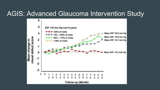 AGIS: Advanced Glaucoma Intervention Study
 
