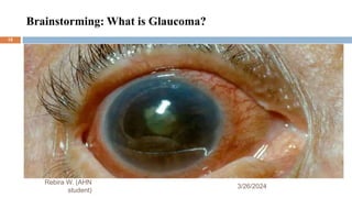 Brainstorming: What is Glaucoma?
3/26/2024
Rebira W. (AHN
student)
15
 