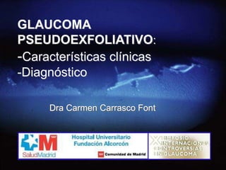 GLAUCOMA
PSEUDOEXFOLIATIVO:
-Características clínicas
-Diagnóstico
Dra Carmen Carrasco Font
 