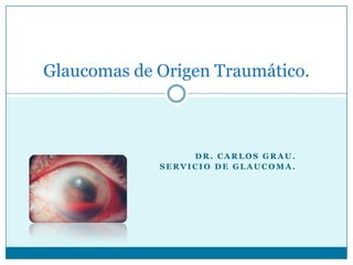 Dr. cARlos grau. Servicio de glaucoma. Glaucomas de Origen Traumático. 