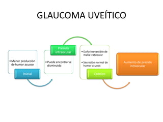 Deposito de material fibrilar en superficie anterior del cristalino.SÍNDROME DE DISPERSIÓN PIGMENTARIA Y GLAUCOMAPérdida crónica del pigmento de la superficie iridiana posterior.En la 3ra década.Antecedente de miopía