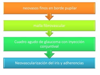 GLAUCOMA UVEÍTICO