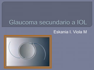 Eskania I. Viola M
 