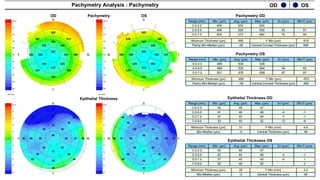 OS
OD
Pachymetry Analysis : Pachymetry
46
Central Thickness (µm)
-2
Min-Median (µm)
3.5
Y Min (mm)
29
Minimum Thickness (µm)
499
Central Corneal Thickness (µm)
-38
Pachy Min-Median (µm)
-875
Y Min (µm)
489
Minimum Thickness (µm)
3
-
55
46
30
7.0-9.0
1
-4
49
45
37
5.0-7.0
-1
-3
48
45
43
2.0-5.0
-
-
47
46
45
0.0-2.0
SN-IT (µm)
S-I (µm)
Max. (µm)
Avg. (µm)
Min. (µm)
Range (mm)
97
67
658
576
501
5.0-7.0
62
50
604
530
489
2.0-5.0
-
-
526
504
489
0.0-2.0
SN-IT (µm)
S-I (µm)
Max. (µm)
Avg. (µm)
Min. (µm)
Range (mm)
46
Central Thickness (µm)
-5
Min-Median (µm)
4.9
Y Min (mm)
31
Minimum Thickness (µm)
498
Central Corneal Thickness (µm)
-35
Pachy Min-Median (µm)
-615
Y Min (µm)
490
Minimum Thickness (µm)
-6
-12
52
45
33
7.0-9.0
-1
-7
49
45
37
5.0-7.0
-1
-4
48
46
41
2.0-5.0
-
-
47
46
45
0.0-2.0
SN-IT (µm)
S-I (µm)
Max. (µm)
Avg. (µm)
Min. (µm)
Range (mm)
90
70
660
573
504
5.0-7.0
57
43
592
528
490
2.0-5.0
-
-
524
502
490
0.0-2.0
SN-IT (µm)
S-I (µm)
Max. (µm)
Avg. (µm)
Min. (µm)
Range (mm)
Epithelial Thickness OD
Epithelial Thickness OS
Pachymetry OS
Pachymetry OD
Pachymetry
OD OS
Epithelial Thickness
 
