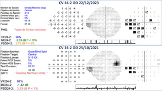 CV 24-2 OD 22/12/2023
CV 24-2 OD 25/10/2021
 