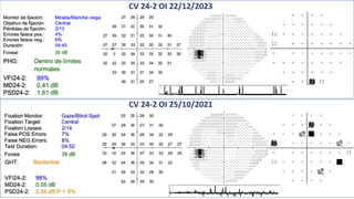 CV 24-2 OI 22/12/2023
CV 24-2 OI 25/10/2021
 