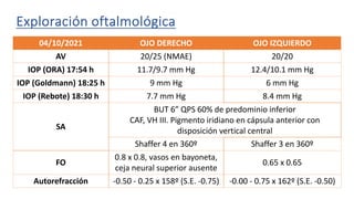 Exploración oftalmológica
04/10/2021 OJO DERECHO OJO IZQUIERDO
AV 20/25 (NMAE) 20/20
IOP (ORA) 17:54 h 11.7/9.7 mm Hg 12.4/10.1 mm Hg
IOP (Goldmann) 18:25 h 9 mm Hg 6 mm Hg
IOP (Rebote) 18:30 h 7.7 mm Hg 8.4 mm Hg
SA
BUT 6” QPS 60% de predominio inferior
CAF, VH III. Pigmento iridiano en cápsula anterior con
disposición vertical central
Shaffer 4 en 360º Shaffer 3 en 360º
FO
0.8 x 0.8, vasos en bayoneta,
ceja neural superior ausente
0.65 x 0.65
Autorefracción -0.50 - 0.25 x 158º (S.E. -0.75) -0.00 - 0.75 x 162º (S.E. -0.50)
 