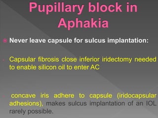  Never leave capsule for sulcus implantation:
- Capsular fibrosis close inferior iridectomy needed
to enable silicon oil to enter AC
- concave iris adhere to capsule (iridocapsular
adhesions), makes sulcus implantation of an IOL
rarely possible.
 