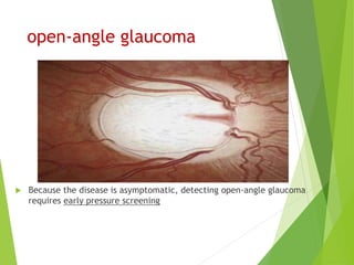 open-angle glaucoma
 Because the disease is asymptomatic, detecting open-angle glaucoma
requires early pressure screening
 