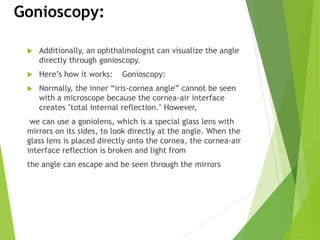 Glaucoma,topic 4 presentation
