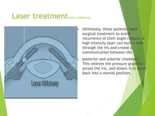 Glaucoma,topic 4 presentation