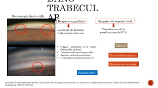 Desgarro superficial Desgarro de espesor total
Lesión de las láminas
trabeculares externas
Visualizacion de la
pared externa del C.S.
Seguimiento
Corticoides tópicos
Supresores acuosos
Manejo
Gonioscopia dentro 48h
Herschler J.daño trabecular debido a una lesión roma del segmento anterior y su relación con el glaucoma traumático. Trans Am Acad Ophthalmol
Otolaryngol 1977; 83: 239-248.
 Colgajo articulado en la región
del espolón escleral.
 Procesos iridianos desgarrados.
 Espolon escleral prominente
 Hemorragia demarcada en C.S.
 