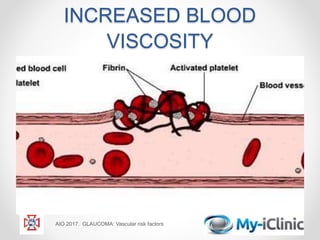 INCREASED BLOOD
VISCOSITY
AIO 2017. GLAUCOMA: Vascular risk factors
 