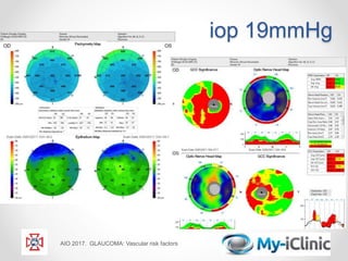 iop 19mmHg
AIO 2017. GLAUCOMA: Vascular risk factors
 