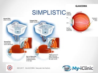 SIMPLISTIC
AIO 2017. GLAUCOMA: Vascular risk factors
 
