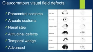 Glaucoma work up and modalities used in diagnosing glaucoma.pptx