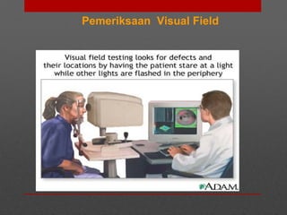 Pemeriksaan Visual Field
 