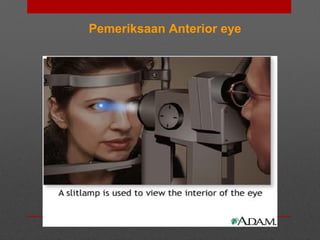 Pemeriksaan Anterior eye
 