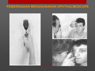 PEMERIKSAAN MENGGUNAKAN OPHTHALMOSCOPE
 
