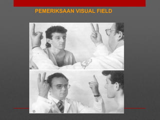 PEMERIKSAAN VISUAL FIELD
 