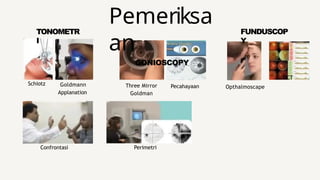 TONOMETR
I
FUNDUSCOP
Y
Goldmann
Applanation
OCT
Three Mirror
Goldman
Schiotz Pecahayaan Opthalmoscape
Confrontasi Perimetri
Pemeriksa
an
GONIOSCOPY
 