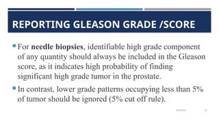 Gleason Material gleason classifaction histopathology and scoring | PPTX