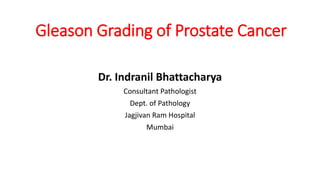 Gleason Grading of Prostate Cancer
Dr. Indranil Bhattacharya
Consultant Pathologist
Dept. of Pathology
Jagjivan Ram Hospital
Mumbai
 
