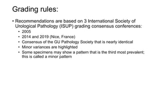 Gleason Grading of Prostate Cancer.pptx