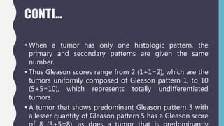 Gleason Material Gleasons scoring system | PPTX