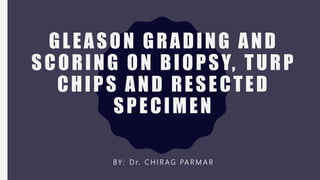 GLEASON GRADING AND
SCORING ON BIOPSY, TURP
CHIPS AND RESECTED
SPECIMEN
BY : D r. C H I R A G PA R M A R
 