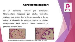 Carcinoma papilar:
es un carcinoma formado por estructuras
fibrovasculares tapizadas por células epiteliales
malignas que ...
