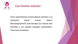 Carcinoma tubular:
Tiene características macroscópicas similares a un
carcinoma ductal invasor clásico.
Microscópicamente ...