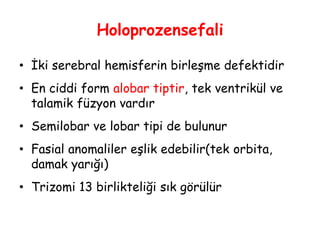 Holoprozensefali
• İki serebral hemisferin birleşme defektidir
• En ciddi form alobar tiptir, tek ventrikül ve
talamik füzyon vardır
• Semilobar ve lobar tipi de bulunur
• Fasial anomaliler eşlik edebilir(tek orbita,
damak yarığı)
• Trizomi 13 birlikteliği sık görülür
 