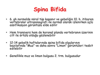 Spina Bifida
• 6. gh normalde nöral tüp kapanır ve gebeliğin 10. h. itibaren
vertebralar ultrasonografi ile normal olarak izlenirken üçlü
ossifikasyon görüntüsü elde edilir
• Hem transvers hem de koronal planda vertebranın üzerinin
cilt ile örtülü olduğu gözlenebilir
• 12-14 gebelik haftalarında spina bifida olgularının
bazılarında "Muz" ve daha sonra "Limon" görüntüleri tesbit
edilebilir
• Genellikle muz ve limon bulgusu 2. trm. bulgusudur
 