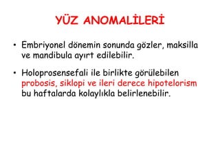 YÜZ ANOMALİLERİ
• Embriyonel dönemin sonunda gözler, maksilla
ve mandibula ayırt edilebilir.
• Holoprosensefali ile birlikte görülebilen
probosis, siklopi ve ileri derece hipotelorism
bu haftalarda kolaylıkla belirlenebilir.
 
