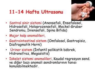 11-14 Hafta Ultrasonu
• Santral sinir sistemi (Anensefali, Ensefalosel,
Hidrosefali, Holoprozensefali, Meckel-Gruber
Sendromu, İniensefali, Spina Bifida)
• Major kalp anomalileri,
• Gastrointestinal sistem (Omfalosel, Gastroşisiz,
Diafragmatik Herni)
• Üriner sistem (İnfantil polikistik böbrek,
Hidronefroz, Megasistis)
• İskelet sistemi anomalileri, Kaudal regresyon send.
ve diğer bazı anomali sendromlarının tanısı
konulabilmektedir.
 
