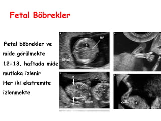 Fetal Böbrekler
Fetal böbrekler ve
mide görülmekte
12-13. haftada mide
mutlaka izlenir
Her iki ekstremite
izlenmekte
 